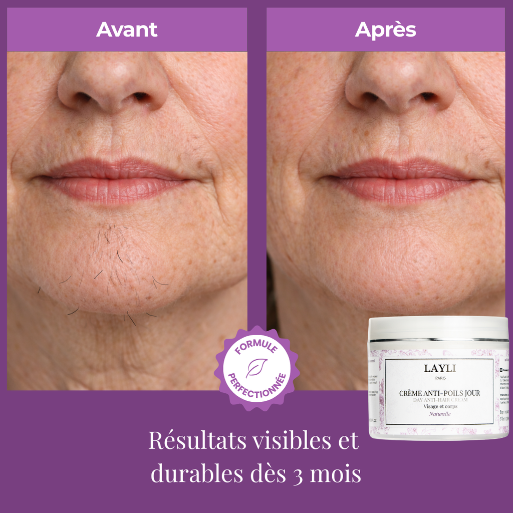 CRÈME ANTI-POILS JOUR • réduction progressive, cycle après cycle !